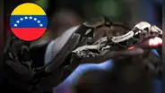 Amputan pierna a niña tras mordedura de serpiente: familia le inyectó orina de venado