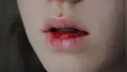¿Qué significa soñar con sangre que sale de la boca de otra persona?