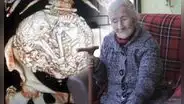 Estela Meléndez, la anciana que tuvo por más de 60 años un feto momificado dentro de su cuerpo