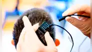 ¿Cómo funciona el implante cerebral que permite a personas con parálisis volver a hablar?