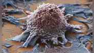 Científicos logran convertir tumores cancerosos en células sanas con tecnología genética