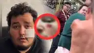 Hincha de Universitario denunció que le desfiguraron la cara en el Monumental en final femenina