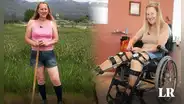 Chloe Jennings-White, la científica que busca la amputación de sus piernas sanas debido a una condición