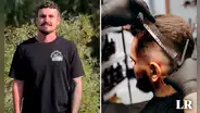 Joven va a cortarse el cabello y descubre que tiene cáncer de piel: le quedan 6 meses de vida