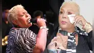 Lucía de la Cruz podría perder la visión a causa de la diabetes: ¿qué medida tomó la cantante?