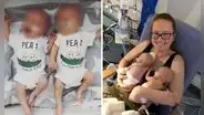 La insólita historia de una mujer que dio a luz a cada uno de sus mellizos con 2 días de diferencia