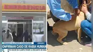 Arequipa: mujer que contrajo rabia humana se encuentra en UCI y con respirador artificial