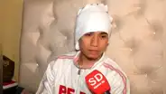 Chancay: joven le arranca la oreja a cantante de cumbia tras una pelea