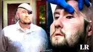 Médicos de EE. UU. logran realizar el primer trasplante de ojo en el mundo
