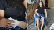 Mujer tiene rara enfermedad en Loreto: transpira sangre por diferentes partes del cuerpo