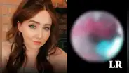 Mujer descubre un nido de arañas dentro de su oído luego de escuchar “crujidos” por semanas