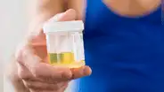 Investigadores de EE. UU. descubren la razón del color amarillo en la orina tras siglos de misterio