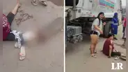 SJL: camión de basura atropella a mujer y ahora corre peligro de que le amputen el pie