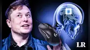 Musk asegura que paciente con chip cerebral Neuralink puede controlar el mouse con la mente