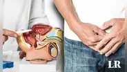 El cáncer de próstata es la primera causa de muerte de los hombres en Perú: ¿cómo prevenirlo?