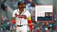 ¿Ronald Acuña Jr. superará su lesión?: este fue el llamativo análisis de médico especialista