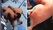 Luchador mordió a su rival, fue expulsado y el dueño de UFC regaló 50.000 dólares al afectado