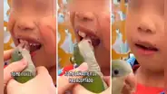 Loro aprovecha distracción de niño para sacarle un diente a punto de caer y lo bautizan: “Perico dentista”