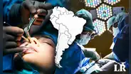 Descubre el país de Sudamérica donde se realizan más cirugías plásticas en el mundo