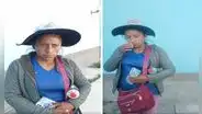 Madre necesita 70.000 soles para reconstruir rostro de su hijo, quien sufrió accidente en Arequipa