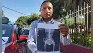 Arequipa: dueño de perro denuncia que veterinaria implantó perno de construcción en columna de mascota