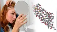 ¿Adiós a la alopecia? Científicos descubren sustancia que podría acabar con la caída de cabello