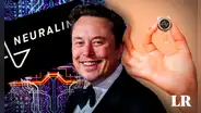 Así funcionan los chips cerebrales de Neuralink con los que Elon Musk revoluciona la neurotecnología