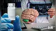 Vacuna experimental contra cáncer cerebral fue probada en 4 pacientes y logran vivir hasta 50% más
