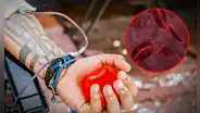 Científicos se encaminan a una posible forma de que la donación de sangre sea universal