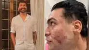 Joven va a clínica de una influencer brasileña a realizarse un tratamiento facial y termina muerto
