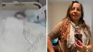 Mujer regresa a Perú desde los EE. UU. para someterse a liposucción y muere tras días de agonía