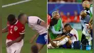 Kylian Mbappé se rompió la nariz: terminó ensangrentado y tuvo que ser cambiado en Francia por lesión