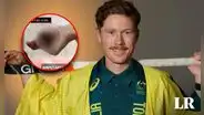 Se amputó el dedo para participar de los Juegos Olímpicos 2024 en París, conoce la historia de Matthew Dawson