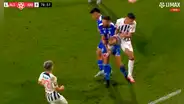 Revelan la fuerte lesión que sufrió el jugador de Alianza Atlético tras la dura entrada de Zambrano