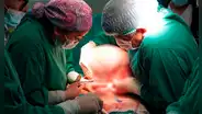Adulta mayor de 61 años sobrevive a extracción de tumor de más 10kg en hospital de El Agustino