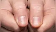 ¿Tus uñas tienen rayas? Descubre su significado y qué puedes hacer al respecto