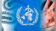 OMS decidirá si declarar rebrote de mpox, antes viruela del mono, como emergencia sanitaria internacional