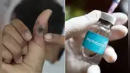 Alerta por viruela del mono: conoce las zonas más afectadas en Perú, vacuna, dosis y efectos secundarios