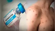 Viruela del mono: ¿Quiénes tienen PRIORIDAD para la vacuna en Estados Unidos por emergencia sanitaria?