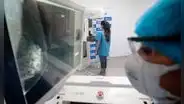 Cáncer de mama en Perú: 6 mujeres mueren diariamente por esta enfermedad, según la OMS