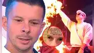 Mario Hart ALARMA al revelar que sufrió una FUERTE LESIÓN en el ojo: "Me clavé uno"