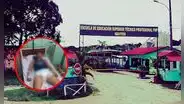 Alumno de escuela policial de Iquitos queda grave tras presunta agresión de sus compañeros: lo habrían golpeado hasta en la vista