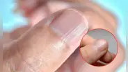 ¿Qué significa tener las uñas con rayas? Esto podría decir de tu salud y así puedes eliminarlas