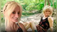 La impactante historia de una mujer de 46 años que envejece 8 veces más rápido por un trastorno genético