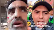 Fernando Llanos se enfrenta a policía que lo empujó por cubrir incendio en el Centro de Lima: “Me has metido una manazo”