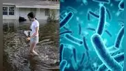 Alerta en Florida: aumentan infecciones por bacteria 'come carne' tras huracanes Helene y Milton en Estados Unidos