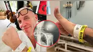 Gian Marco reaparece y revela detalles sobre su delicado estado de salud: "Me van a infiltrar la columna"