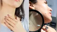 Líneas en el cuello: ¿es un signo de envejecimiento, mala salud o algo más? descúbrelo aquí