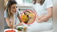 Este es el alimento que se consume cada mañana y podría aumentar el riesgo de sufrir enfermedades