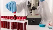 ¿Cómo saber qué tipo de sangre soy? Descubre a qué grupo sanguíneo perteneces y cuál es su significado